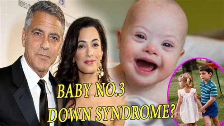 Does One of George Clooney's Twins Have Down Syndrome? Unraveling the Truth
