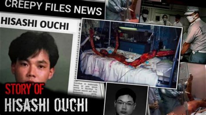 Hisashi Ouchi: The Tragic Story Behind the Real Photos