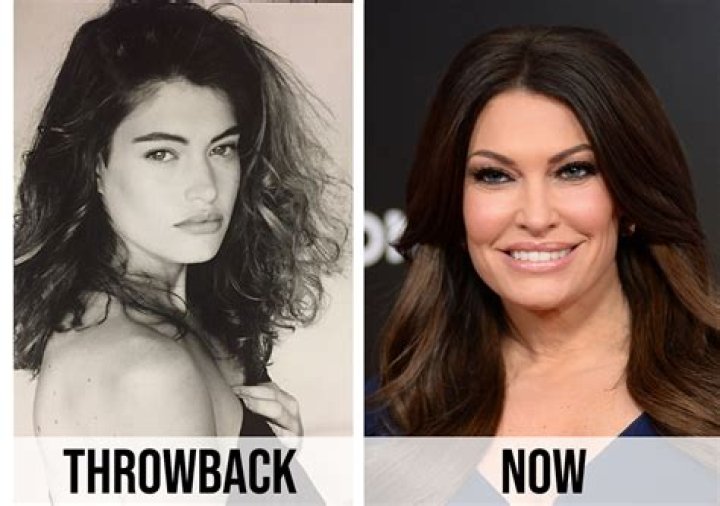 Kimberly Guilfoyle's Plastic Surgery Journey: A Comprehensive Overview