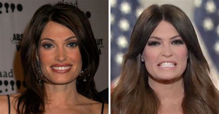 Kimberly Guilfoyle Surgery: The Journey of Transformation and Resilience