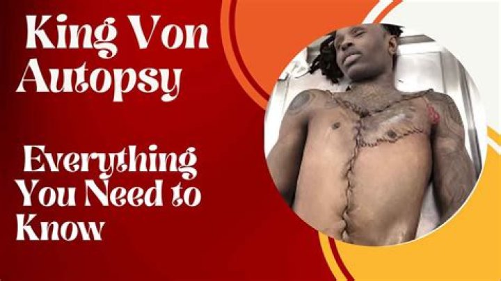 King Von Autopsy Report: Unveiling the Truth Behind the Rapper's Tragic Death