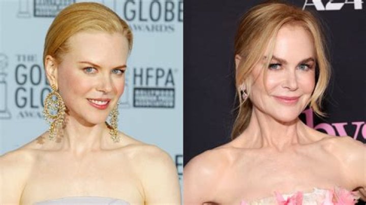 Nicole Kidman Plastic Surgery: A Comprehensive Look at Her Transformation and Choices
