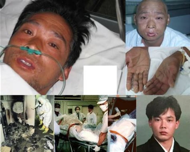 Real Photo Hisashi Ouchi: The Untold Story of a Tragic Nuclear Accident Victim