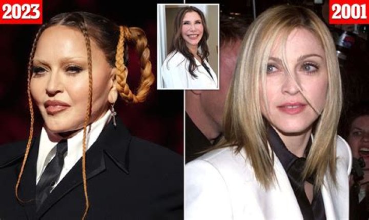 Unraveling the Speculation: Did Amanda Seyfried Have Plastic Surgery?